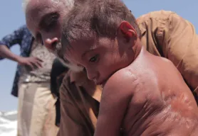 The shrapnel in her back didn't kill her. But without your help, she may die of hunger.  