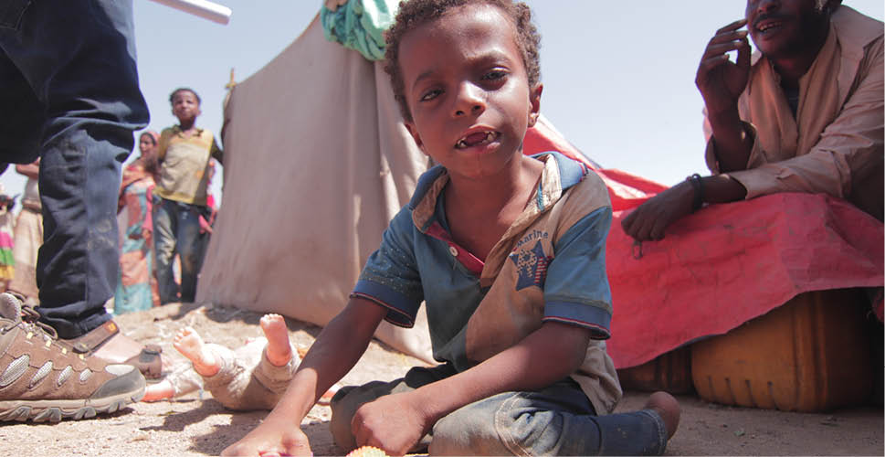 He s 7 years old and has an infectious smile  Yet he cannot speak  Qwagdhi s eyes flit from one stimulus to another: a child s shriek here, a call from an adult there  He swivels on the hips that serve as a sort of a stable axis, for the rest of his torso      He s never been OK,  Ali, his dad, said     Qwaghdi sufferes from some sort of neuro-muscular and developmental disability  His father does not know which, or why  Only that he was born this way, and he responds to touch    Qwaghdi loves being picked up and sitting in laps  The three or four small toys that bring Qwaghdi joy are among the family s only possessions  A purple car with wheels  A blue rubber dinosaur  A doll that looks like it was left behind and trampled upon in a theme park, sentenced to a short life in the lost-and-found bin    Yet these bring Qwaghdi joy  He spends his days with his father and an older sibling  Flies flit about his face, in and around his eyes  Drool spills from his bright smile as he vocalizes on vowels     Qwaghdi would you like to play      Ayieeeee      Airstrikes forced Ali and older children to flee, carrying Qwaghdi from Taizz  As the family searches for food Qwaghdi is left alone, laying in the family s baking tent, unattended but for the gaze of his threadbare doll and blue dinosaur   It is called Shab 3  Yemen s government has been trying to keep up with the sheltering demand as fighting continues in the north  Down a dusty gravel road on the outskirts of Aden, a city of 1 million, are a pair of displacement camps  Gray cinderblock walls outline the plots the government has earmarked for Shab 3 contains the overflow from a camp across the gravel road  It s been open for around 30 days and does not have any support     There is one latrine for 39 households  Households is an auspicious term: the shacks the families call home are made from scraps they find in scavenging  While services like food, water and working latrines trickle in to other displacement camps nothing has arrived here  The families get by searching trash for food  A directive from the government ministry in charge of providing services to displaced people has banned begging for money, food and other items on Aden s streets  One gets the sense the government minders look the other way, knowing these families have no other choice to survive     The sun beats down on dusty desert in the walled-off courtyard during the day  Families complain of the cold at night  Each family has a clutch of papers bound in myriad ways they count on as evidence of their plight: official papers on letterhead endorsing their displacement by air strikes  A discharge paper from a medical charity or local hospital  One mother in burqa is quick to show the sonogram of a baby yet to be born into this world, knowing the clock is ticking for her to find some kind of help before her child takes a first breath as an outcast, a casualty of a war before even being able to say it as a word     International actors know about the camps in Aden and along Yemen s south coast  They stretch for hundreds of miles, along what at one time was some of the world s most beautiful beaches  There is nothing beautiful about life in Yemen these days for those who have had no choice but to run for their lives  They have not crossed international borders so as to classify as refugees, which may ratchet up their case for need ever so slightly  They are among more than 65 million displaced people on this planet, where changing climates, endless wars, thirst for profits and economic injustice keep innocent people at risk  